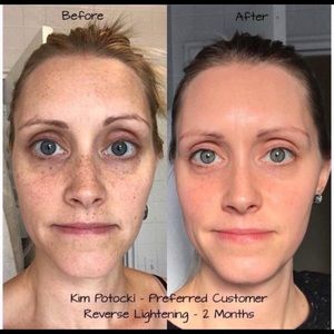 Raving reviews - market's best brightener toner